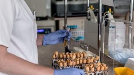 В Воронежской области стали чаще болеть ветряной оспой и коклюшем