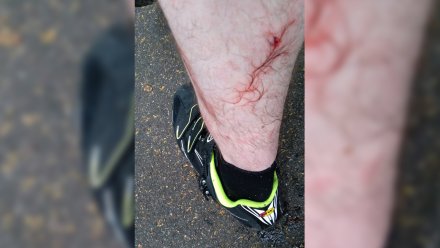 Собака с чипом напала на воронежского велосипедиста в «Олимпике»