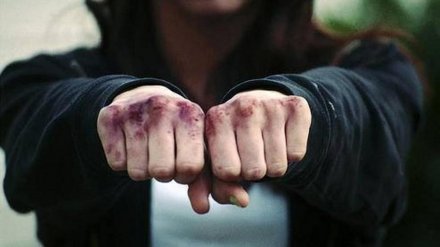 «Как в страшном кино». Молодёжь жестоко избила воронежца и распылила ему в лицо баллончик