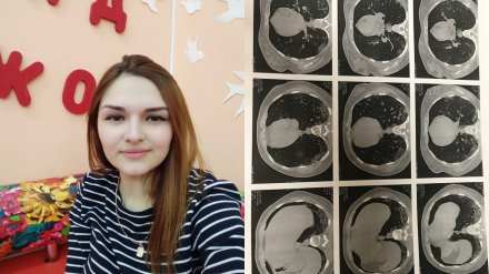 «Лёгкие будто обдали кипятком». Девушка с COVID-19 из Воронежа рассказала о болезни