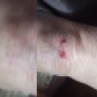 В Воронеже пенсионерка упала и поранила ноги из-за опасного бордюра на остановке