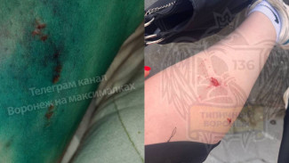 Ещё две девушки пострадали от нападения агрессивных собак в разных районах Воронежа