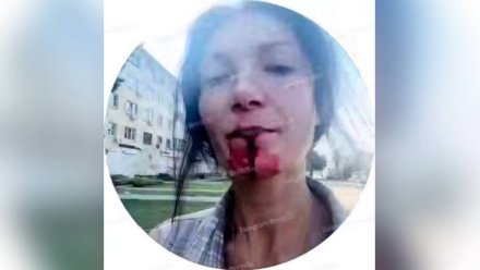 Прокуратура возбудила дело после избиения девушки скейтбордом в Воронеже