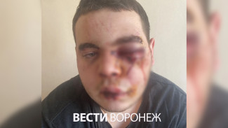В Борисоглебске профессиональный боксёр избил парня до сотрясения мозга