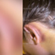 17-летняя девушка получила травму позвоночника во время гонок на картинге в Воронеже
