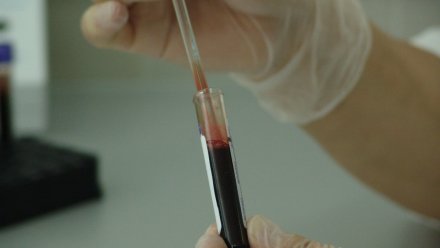 Свыше 47 тысяч исследований для выявления онкологии провели жителям региона в 2025 году