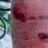В Воронеже не смогли поймать напавших на девушек собак на Олимпийском бульваре