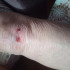 В Воронеже пенсионерка упала и поранила ноги из-за опасного бордюра на остановке
