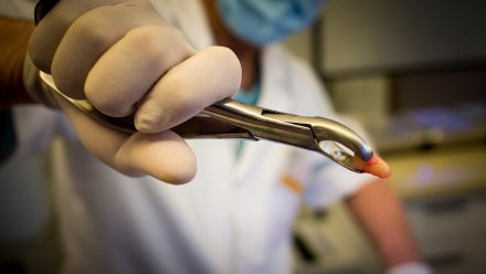 Воронежские врачи рассказали об удалении зуба пациентке с коронавирусом