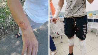 «Пламя выстрелило в людей». Жители воронежского села пожаловалась на ожоги после фаер-шоу