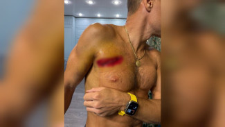«Хлестала кровь». Пострадавший воронежец рассказал о поножовщине в «Бархате»