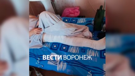 В Воронеже девочка получила оскольчатый перелом из-за закрывшейся двери маршрутки
