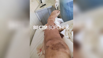Впал в кому, остался без ноги. Жена рассказала о травмировании воронежца на работе в Лисках