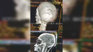 В Воронежской области обломки БПЛА упали на машину с 3 женщинами