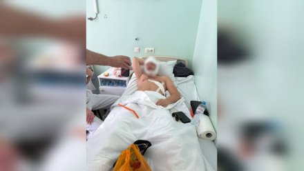 «Лицо набок». Стало известно самочувствие второго пострадавшего у «Бархата» воронежца