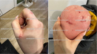 Ребёнку-инвалиду выплатили 50 тысяч после падения наледи с ТЦ «Европа» в Воронеже