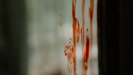 В Воронежской области на мясокомбинате лифт зажал голову 33-летнего грузчика