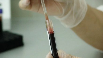 В Воронежской области выявили первые два случая заражения коронавирусом