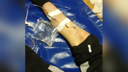 Врачи скорой использовали дрель для спасения от смерти воронежца с кровотечением