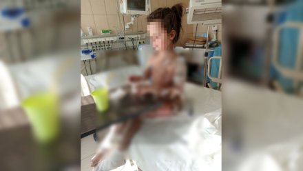 В воронежской клинике не узнали свою пациентку в девочке с отслоившейся кожей