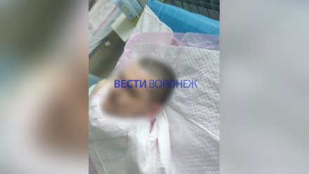 В Воронеже парень попал в реанимацию после падения с высоты на стройке 