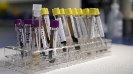 Воронежцам предложили услуги выездной медицинской лаборатории