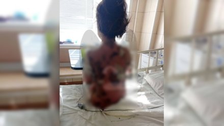 Историю с пострадавшей после лечения в Воронеже девочкой взял на контроль Бастрыкин