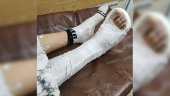 Появились подробности ДТП со сбитым на Антонова-Овсеенко 14-летним воронежцем