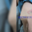 В Воронеже сбежавший от родителей инвалид ударил троих детей на улице