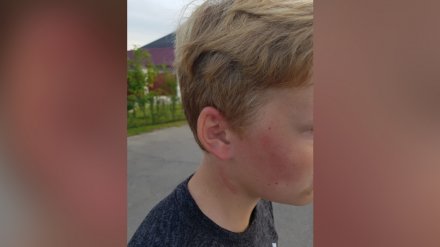 Под Воронежем на избитого экс-полицейским 12-летнего мальчика подали заявление в МВД