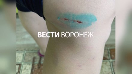 В центре Воронежа свора бездомных собак набросилась на прохожую