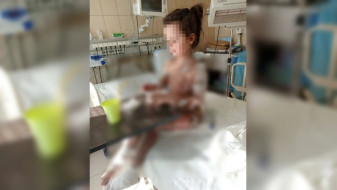 «Еле вытащили». Адвокат рассказал о состоянии девочки из Воронежа после отслоения кожи